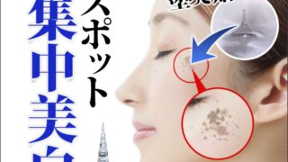 エステナードリフティ